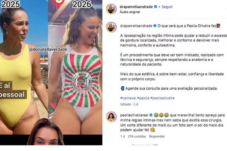 Paolla Oliveira reage a vídeo que comenta mudança em sua região íntima e nega procedimento estético 1 Página Press
